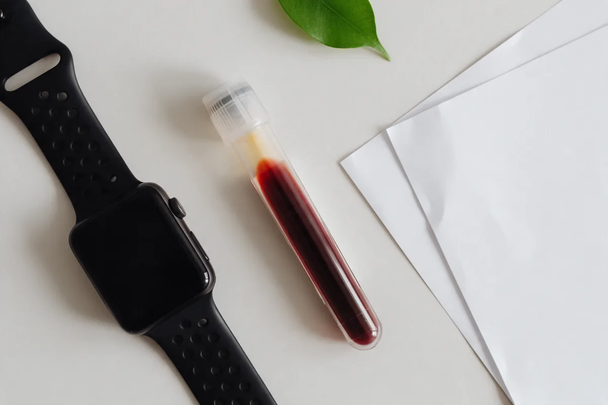 Reloj inteligente junto a un tubo de laboratorio y documentos